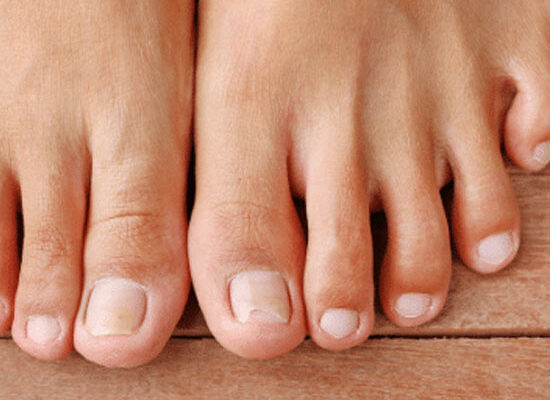 Künstlicher Nagelersatz / Nagelprothetik